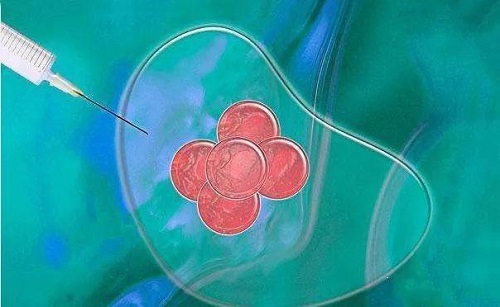 试管已生的总结，要注意什么？